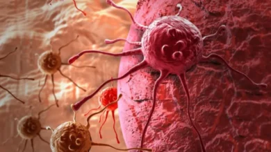 الخلايا السرطانية