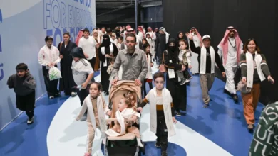 التوائم الملتصقة